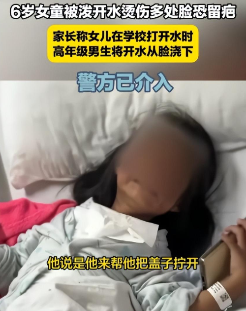 痛心！广东6岁女童校园内被开水严重烫伤，学校和教育局回应遭质疑(图1)