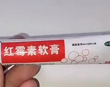 宝宝红屁屁别乱涂药！红霉素软膏的正确用法看这里(图1)